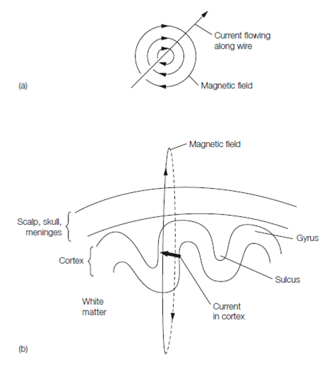 2185_Magnetoencephalography (MEG).png